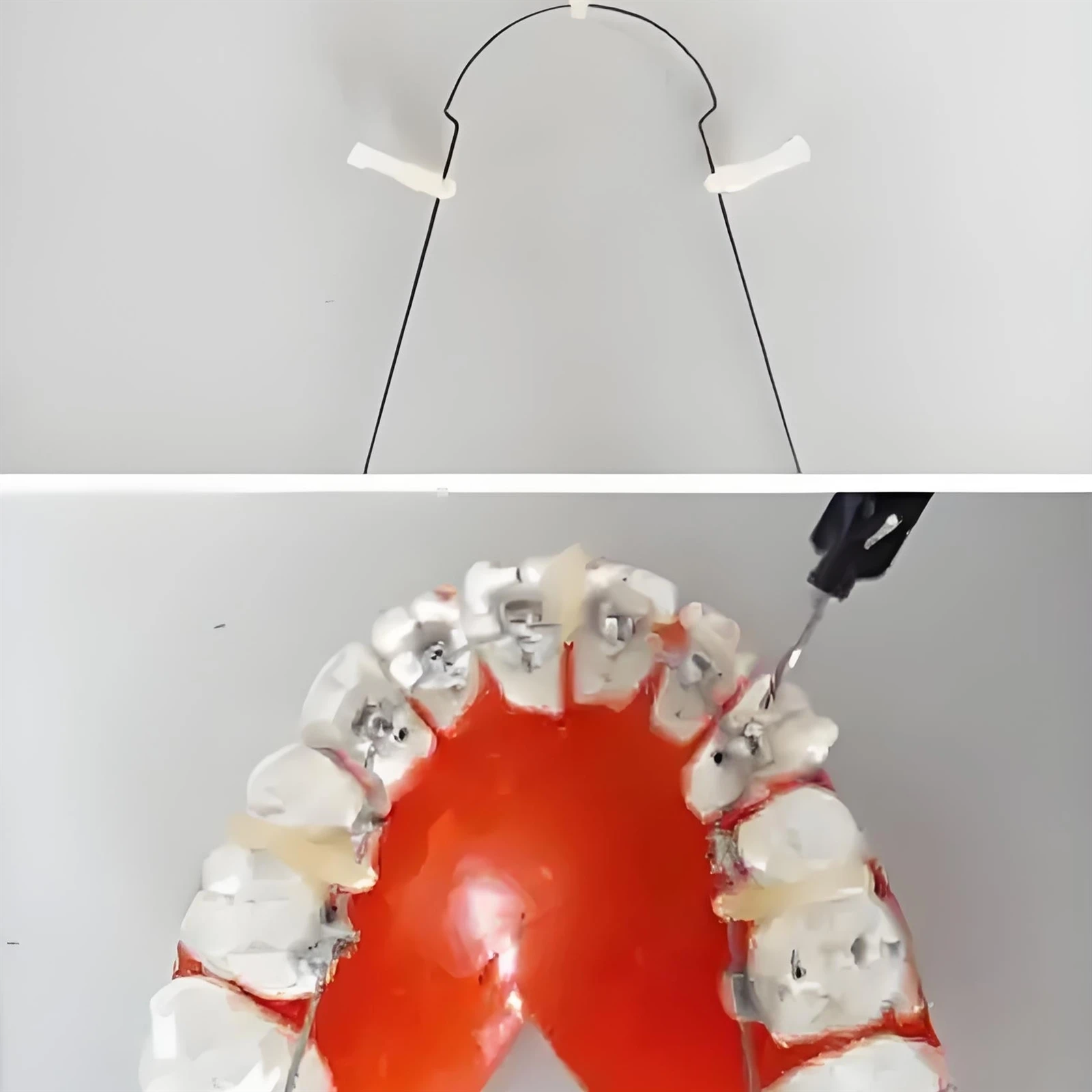 Dental archwires Dental archwires
